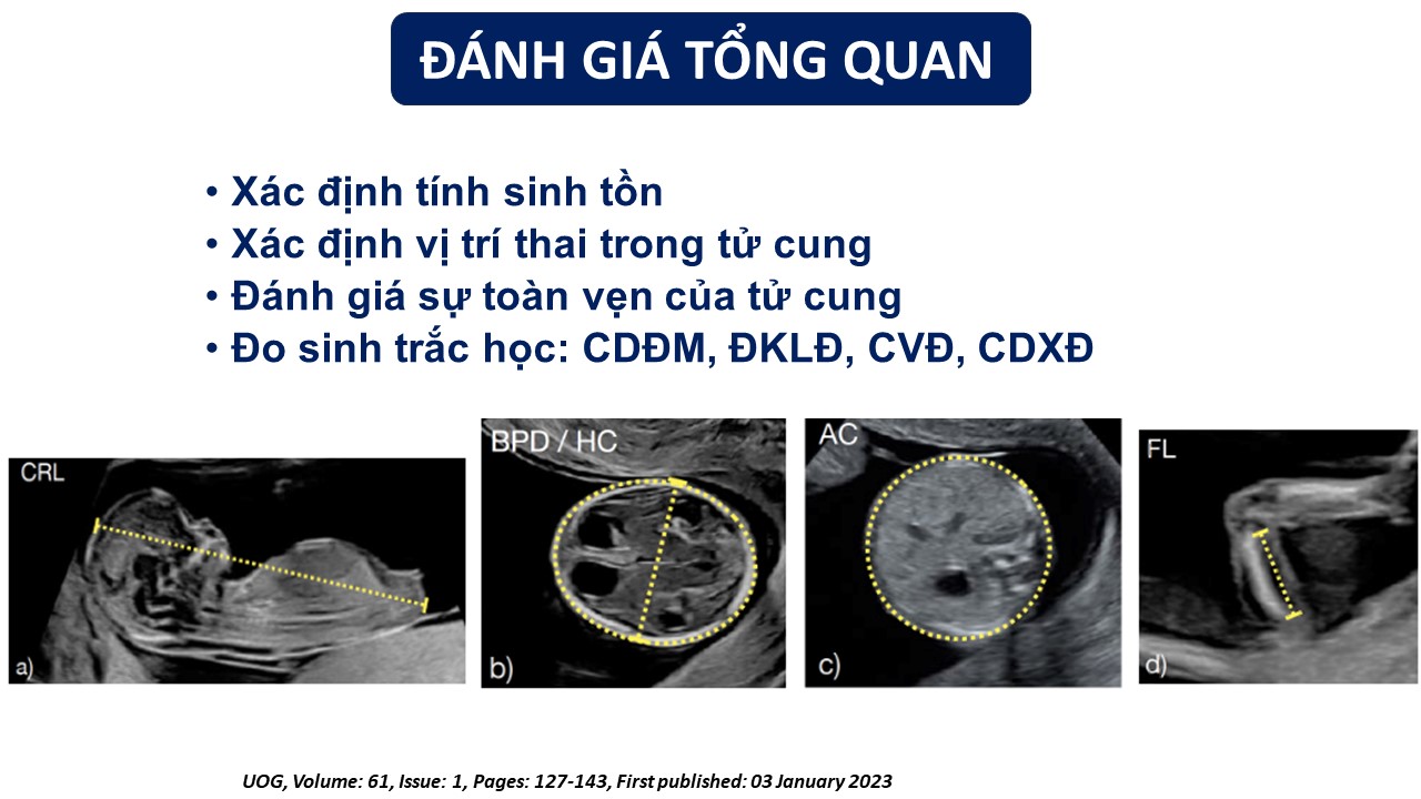 S Ng L C V Ch N O N Tr C Sinh Xu H Ng Hi N T I T Ng Lai